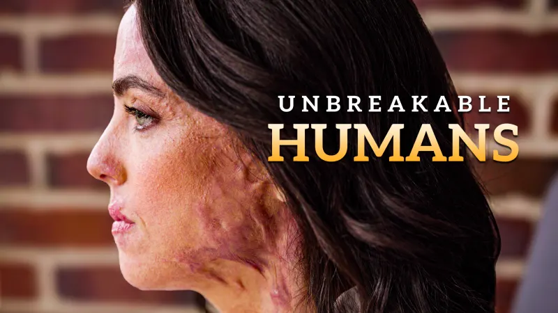 Where to Watch Unbreakable Humans
